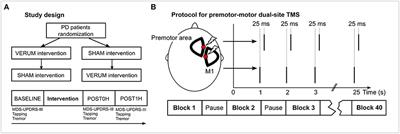 Dual-Site Transcranial Magnetic Stimulation for the Treatment of Parkinson's Disease